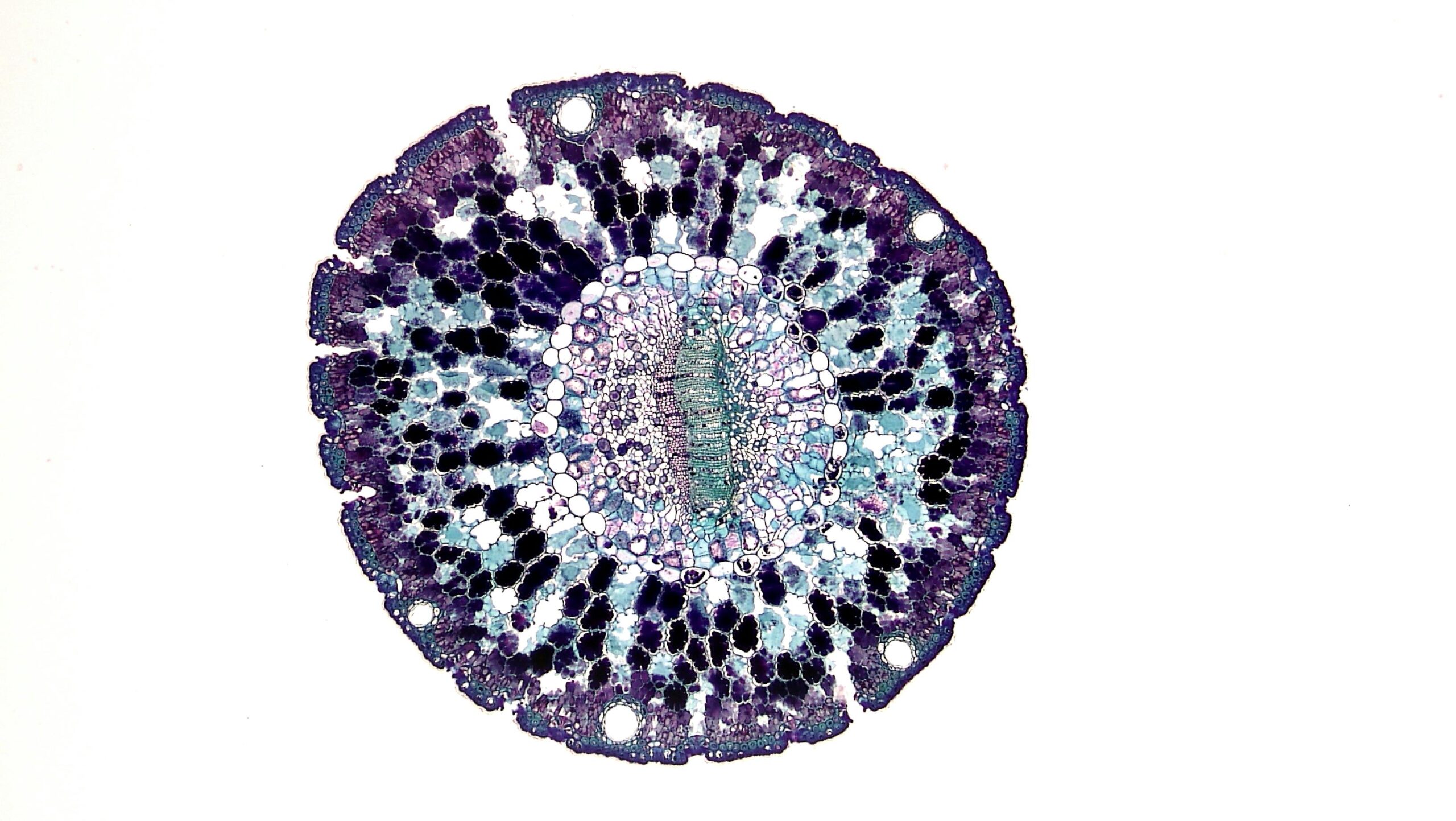 Study in Hungary finds that Deuterium depletion is the key to getting a breakthrough in cancer therapy